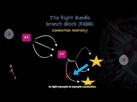 Understanding Right Bundle Branch Blocks - Good Reads 9-2024