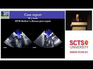 Circumflex artery injury during mitral valve repair