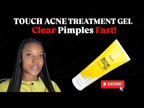 TOUCH ACNE TREATMENT GEL: Clear Pimples Fast!✅