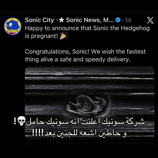 الله ياخذهم طيروا نومي و دمروا الطفوله #explore #fyp #sonicthehedgehog #سونيك #sonic