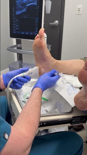 Ultrasound guided cortisone injection #footpain