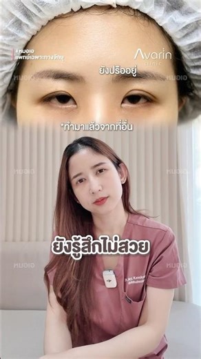 Why does my eyelid surgery still not look good? 😱 #CorrectingWeakEyelidMuscles #WeakEyelidMuscles...