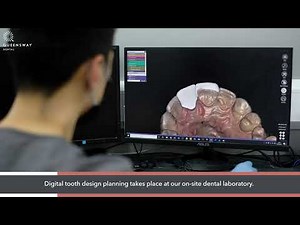 Veneers & Crowns - What's the difference?