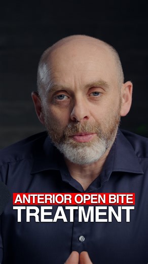 Dr. Kieran Daly | An anterior open bite occurs when the upper and lower front teeth do not touch when the mouth is closed, creating a gap between them. This... | Instagram