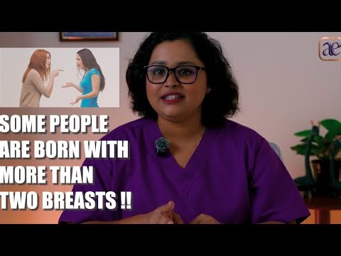 Born with more than two breasts !!