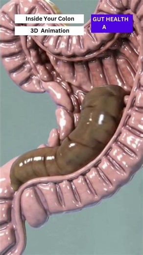 Incredible 3D Animation of Your Colon!