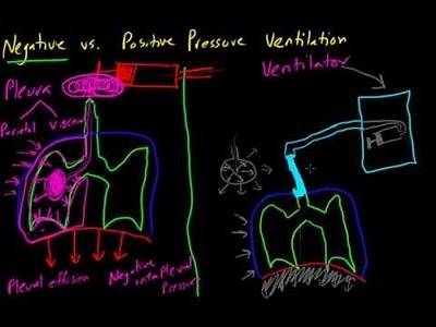 Negative vs. Positive Pressure Ventilation