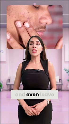 STOP using toothpaste as a face mask! #skincare #soulskinclinic