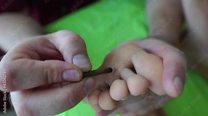 Therapist performing moxibustion procedure at health center. Moxibustion is a thermal effect on biologically active points located across the entire surface of the human body.