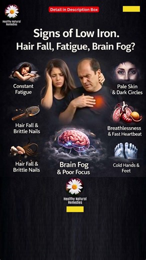 Signs of Low Iron. Hair Fall, Fatigue, Brain Fog? #irondeficiency #ytshorts #trending #health