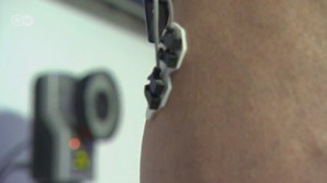 Motion capture for better prosthetics