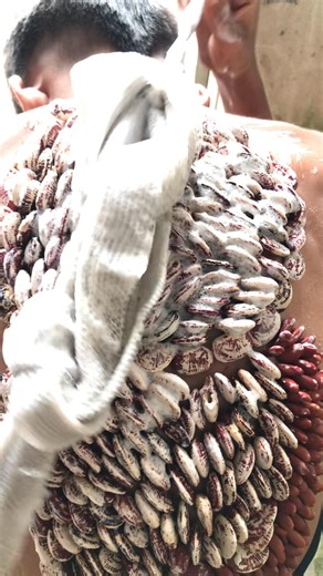 Part15 Omg ticks stuck to my leg i was so scared and in so much pain #ticksremoval #removal #removals #trend # | Barzil Lice