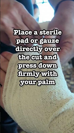 Hand Bandaging – Direct Pressure Fast