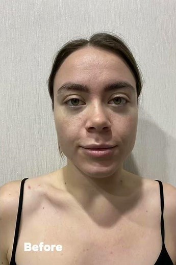 Challenge results #challenge #facechallenge #selfcare #beforeafter