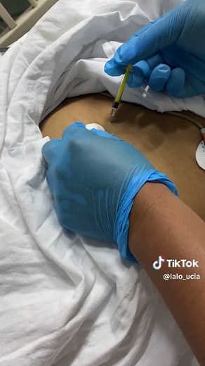 Cuidados de Enfermeria en la aplicación de Enoxaparina. #enoxaparina #heparinadebajopesomolecular #heparina #anticoagulantes #cuidadocriticodeenfermeria #enoxaparin #pacientegrave #tromboprofilaxis #trombosisvenosaprofunda