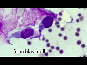 Fibroblast cells morphology