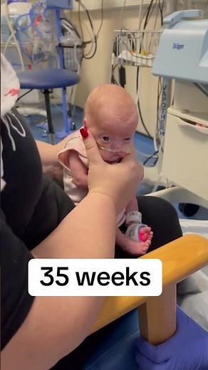 35 Weeks premature baby life journey🥺 Please pray🙏#baby #premature #35weeksbaby #babyshorts #shorts