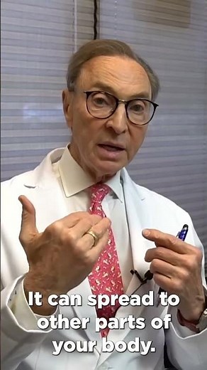 How to Treat Candida at Home: Doctors Advice #dentist #dentalhygiene #candida