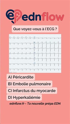 QUEL EST TON DIAGNOSTIC ? #edn #medecine