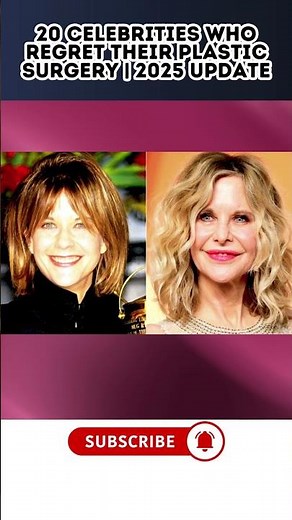 20 Celebrities Who Are Now UNRECOGNIZABLE! | Plastic Surgery Fails 2025 Update Part 2