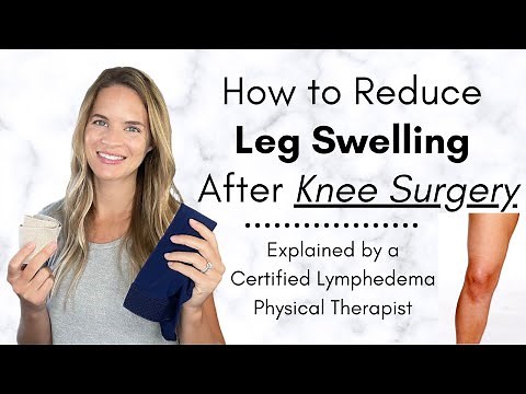 How to Reduce Leg Swelling After Knee Surgery - By a Physical Therapist