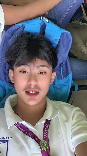 Effective DIY Braces: How to Make Fake Brace at Home