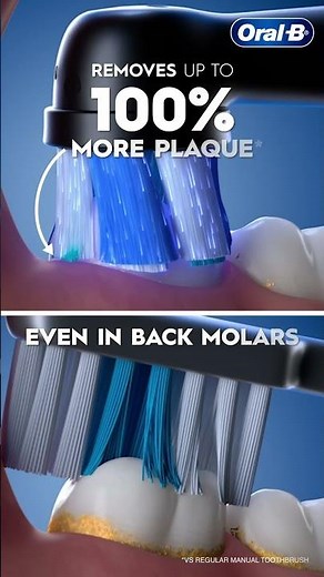 New Oral-B IO2 Electric Toothbrush 6S