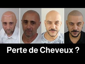 La technique parfaite pour moi: La Dermopigmentation des cheveux