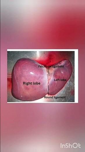"Real Human Liver | Anatomy Explained Clearly"