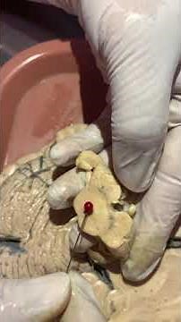 Neuroanatomía: anatomía interna del mesencéfalo II.
