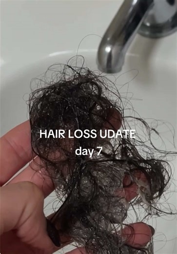 Day 7 hair update 🤍 I started this series because I’ve been losing my hair — and I wanted to track it properly, honestly, and in real time. Confession… I’ve had my extensions put back in. I can’t live without them — they make me feel confident — but my real hair is still very much underneath. I’ve worn extensions for 12 years and they are not the cause of my hair loss (disclaimer done, let’s move on 😅). When I have my refit in 4 weeks, I’ll be showing my real progress without them in. It’s sti