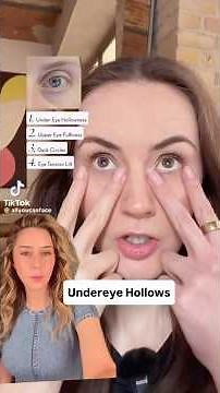 Why Your Under-Eyes Look Hollow + What Actually Helps from a Dermatologist