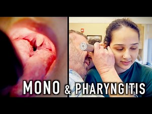 MONO & PHARYNGITIS (Crazy Story) | Dr. Paul