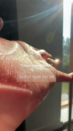 cuando el sudor interfiere con tu día a día, no siempre es un tema cosmético 🌤️ Existen abordajes médicos que ayudan a regular la sudoración en zonas específicas, mejorando comodidad, confianza y bienestar diario. Es una opción no quirúrgica, pensada para acompañarte especialmente en épocas de calor. Si quieres orientación médica, agenda una evaluación conmigo 💬📅 #medicinaestetica #botox #hiperhidrosis #sudoracionexcesiva #verano ¿Qué es la hiperhidrosis y porq da? ‌