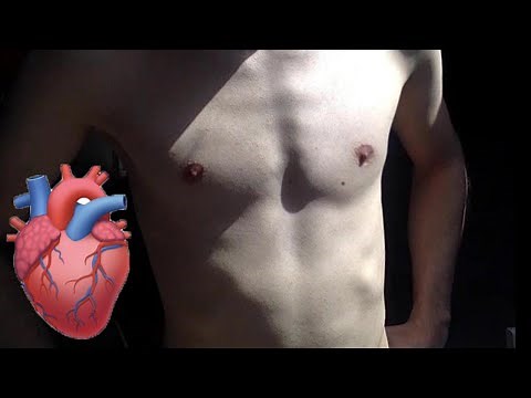 Very fast and visible heartbeat