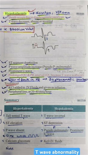 T wave abnormality ..🤔 #shorts #trending #viral #medicalshorts #mbbs #medicalreels #twave #ecg