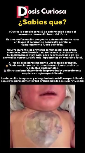 La enfermedad más impactante que nunca viste #medicofacts