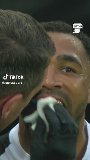 Callum Wilson's Tooth Injury: A Premier League Moment