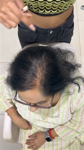 1.4M views · 3.4K reactions | Hair Thinning Solution For Wide Parting For Women & Men | Using Hair Powder | 1 Hair Stop India | Facebook