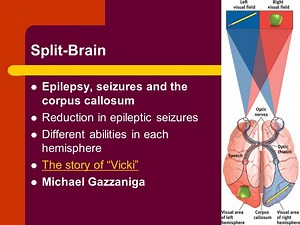 Corpus Callosotomy Surgery: Användningar, Effekter, Recovery, och mer - Epilepsi 2025
