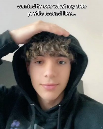 Dr. Raj Kanodia- Doc Hollywood on Instagram: "@nickbencivengo 10 months closed scarless septo-rhinoplasty. Male rhinoplasty involves extreme finesse, and extensive knowledge of the unique characteristics of the male face to preserve the masculinity."