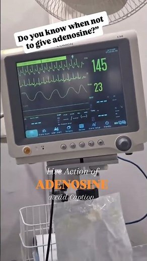 live Action of Injection Adenosine