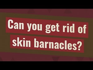 Can you get rid of skin barnacles?