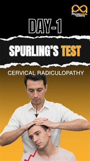 How to perform: 1 Patient seated 2 Extend, side-bend & rotate neck toward affected side 3 Apply gentle downward pressure ▲ Positive test: Pain or tingling radiating into the arm Used to assess cervical nerve root compression Save & follow us for more special tests #spurlingtest #reelsinstagram #physiotherapy #physiostudents #explore | Physio Needs Academy