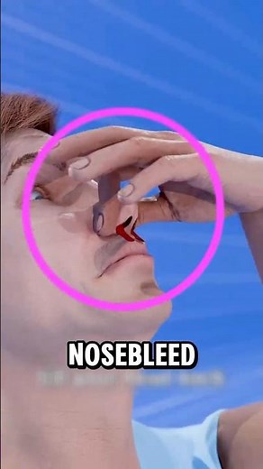 What To Do If You Get a Nosebleed 👃🩸