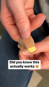 6.4M views · 11K reactions | Potato removes deep splinter Wes & Alison share a helpful first aid tutorial tip using a potato slice to extract a splinter. This original video was produced by Wes and Alison. | Life According to Us | Facebook