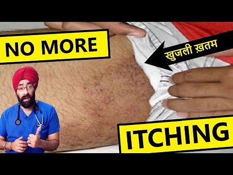 How to cure itching in private part | fungal infection | daad khaj khujli ka ilaj | Dr.Education