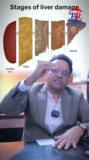 Fatty Liver Warning Signs Explained | Dr P K Gupta | Liver Health