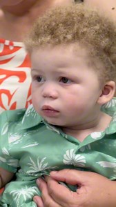 One Sunday in Ceres, little 8 month old Gran-Janvee was crawling behind his mom Chantal when tragedy struck. While the kettle boiled on the floor (the only safe spot in their Wendy house), Gran-Janvee knocked it over and sat in a puddle of boiling water. Chantal acted fast, ripping off his clothes and pouring cold water over him, saving most of his body. But she forgot his socks… they soaked up the boiled water and caused deep burns on his tiny feet. Thanks to YOUR donations to the Children’s Ho