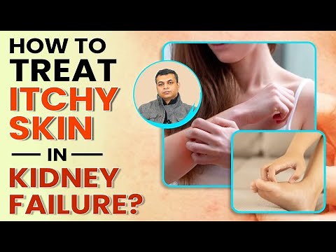 How To Treat Itchy Skin In Kidney Failure ?